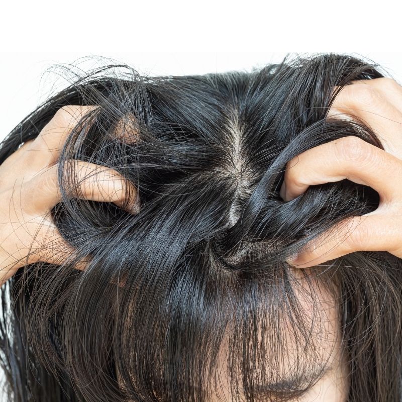 saç dipleri neden acır