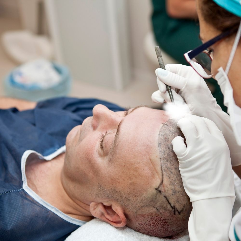 Saç ekimi sonrası bere ne zaman takılır