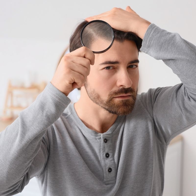 Saç Dökülmesi Nasıl Önlenir