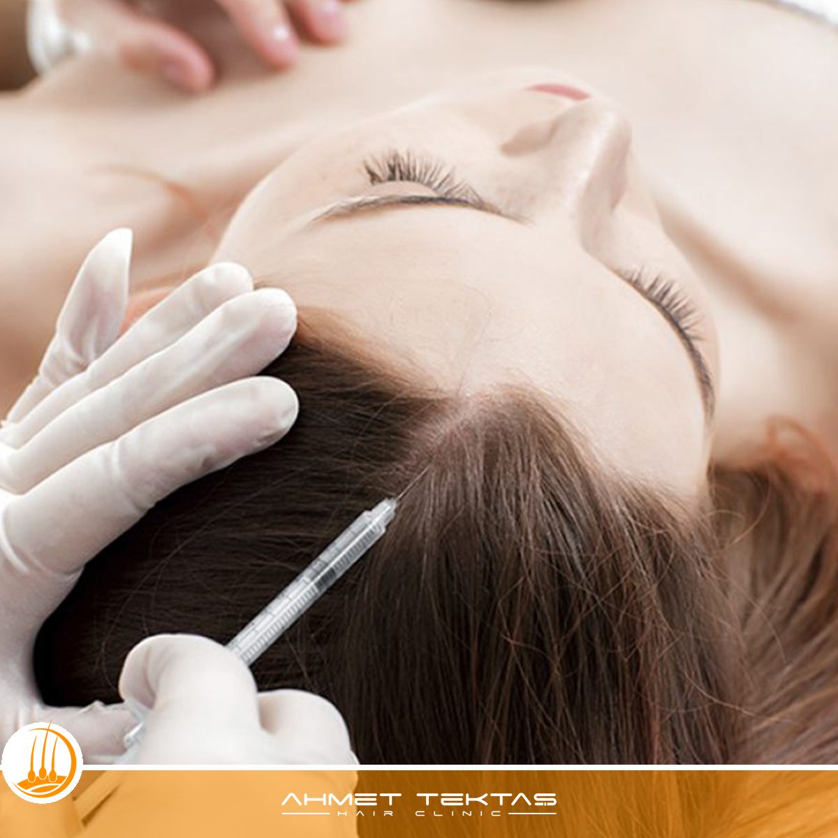 Kahramanmaraş Saç Mezoterapisi