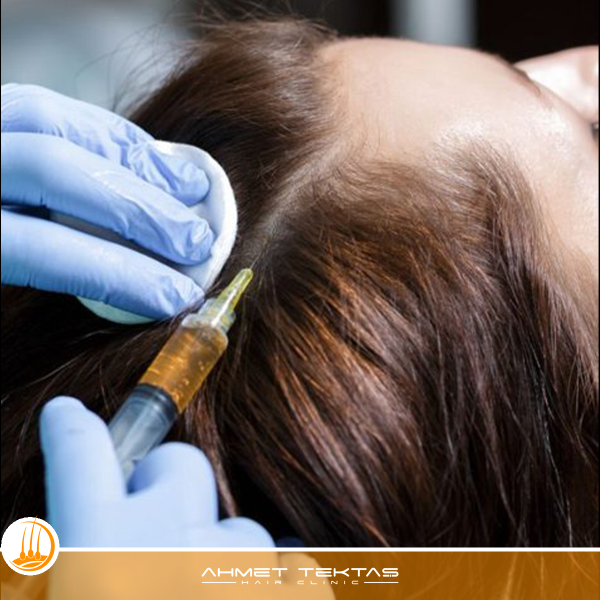 Kahramanmaraş Saç Mezoterapisi