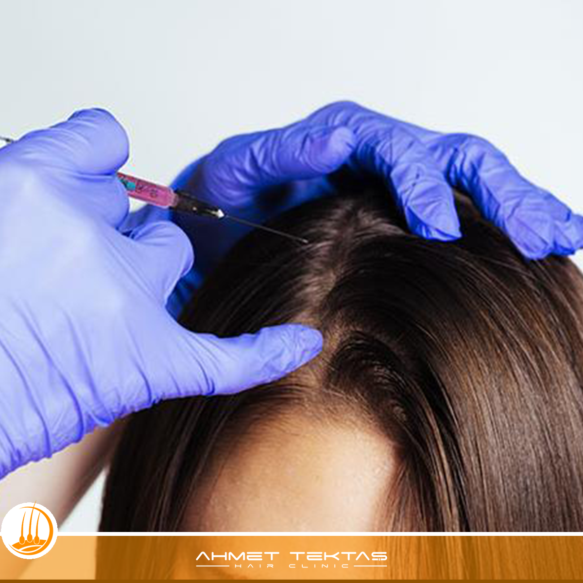 Kahramanmaraş Saç Mezoterapisi