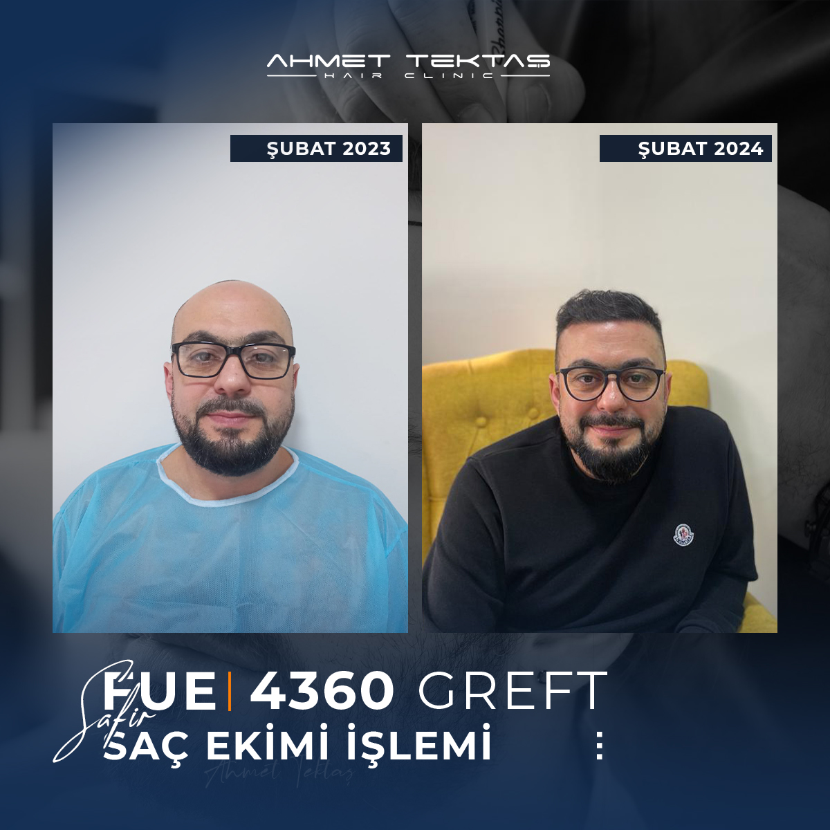 Kayseri Saç Ekimi, Okan Bey Kayseri Saç Ekimi, Okan Bey