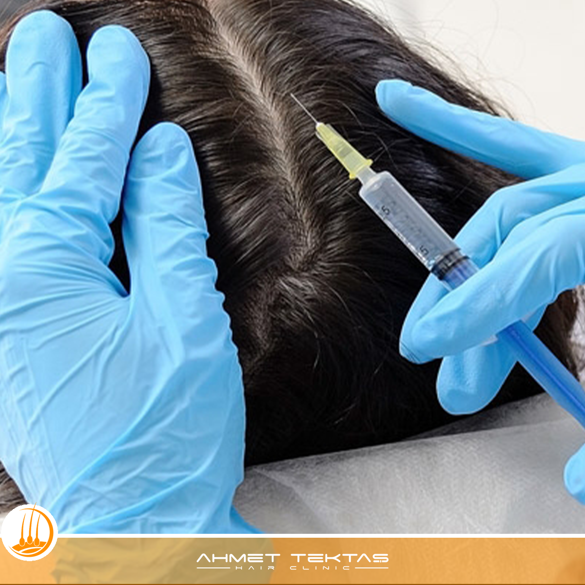 Kırşehir Saç Mezoterapisi