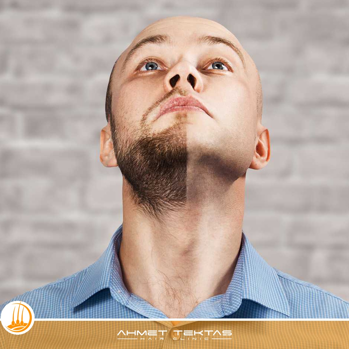 Kırşehir Sakal Ekimi