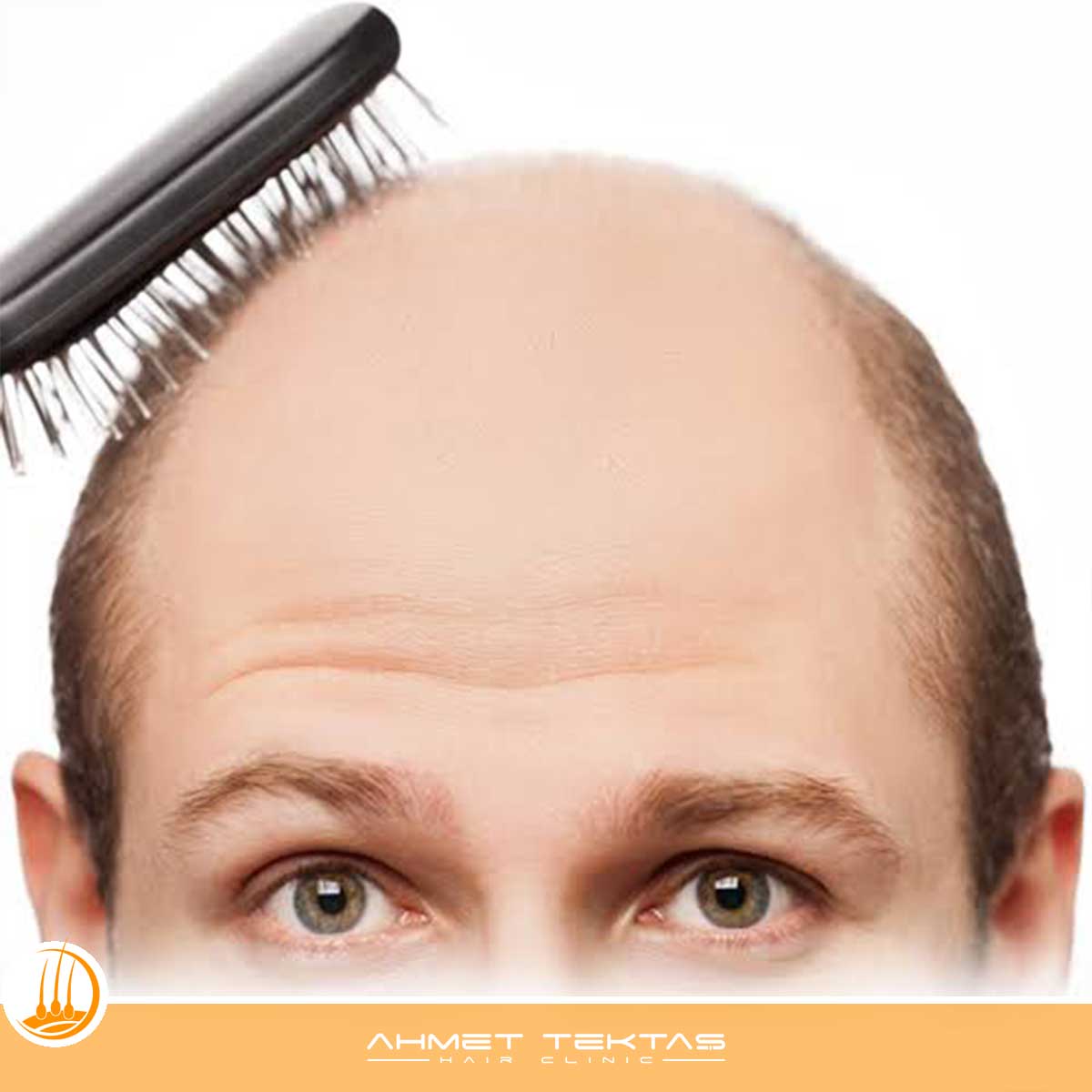 Kırşehir VIP Saç Ekimi