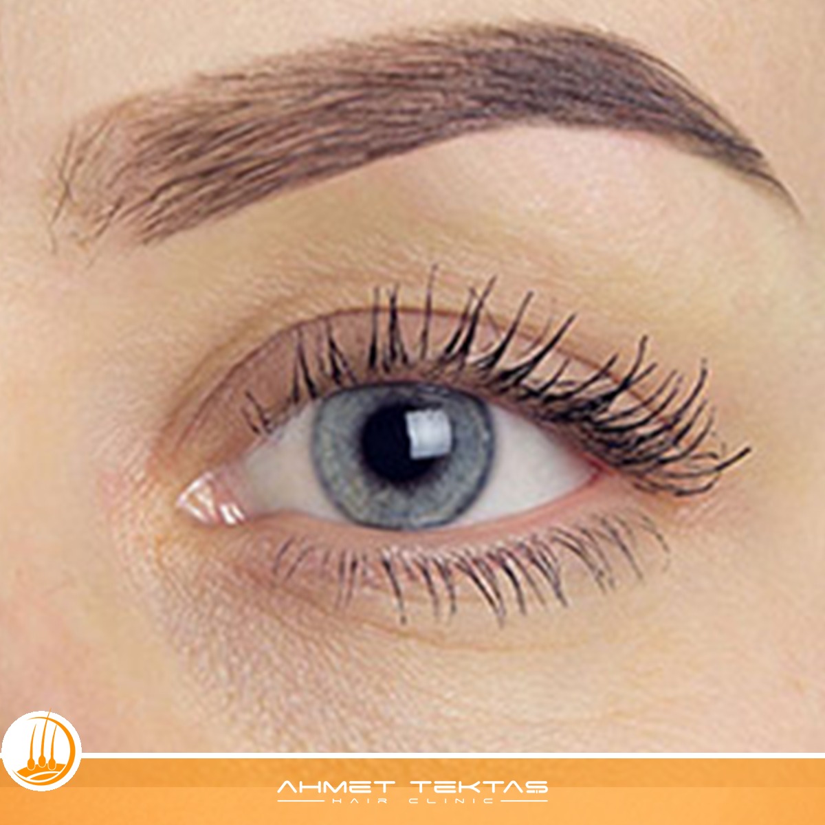 Nevşehir Kaş Ekimi