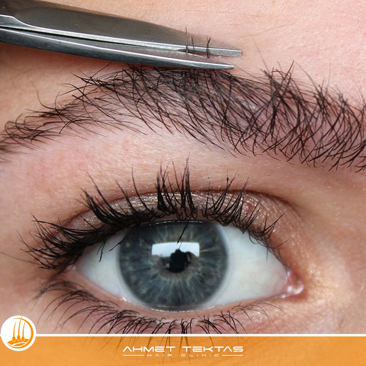 Nevşehir Kaş Ekimi