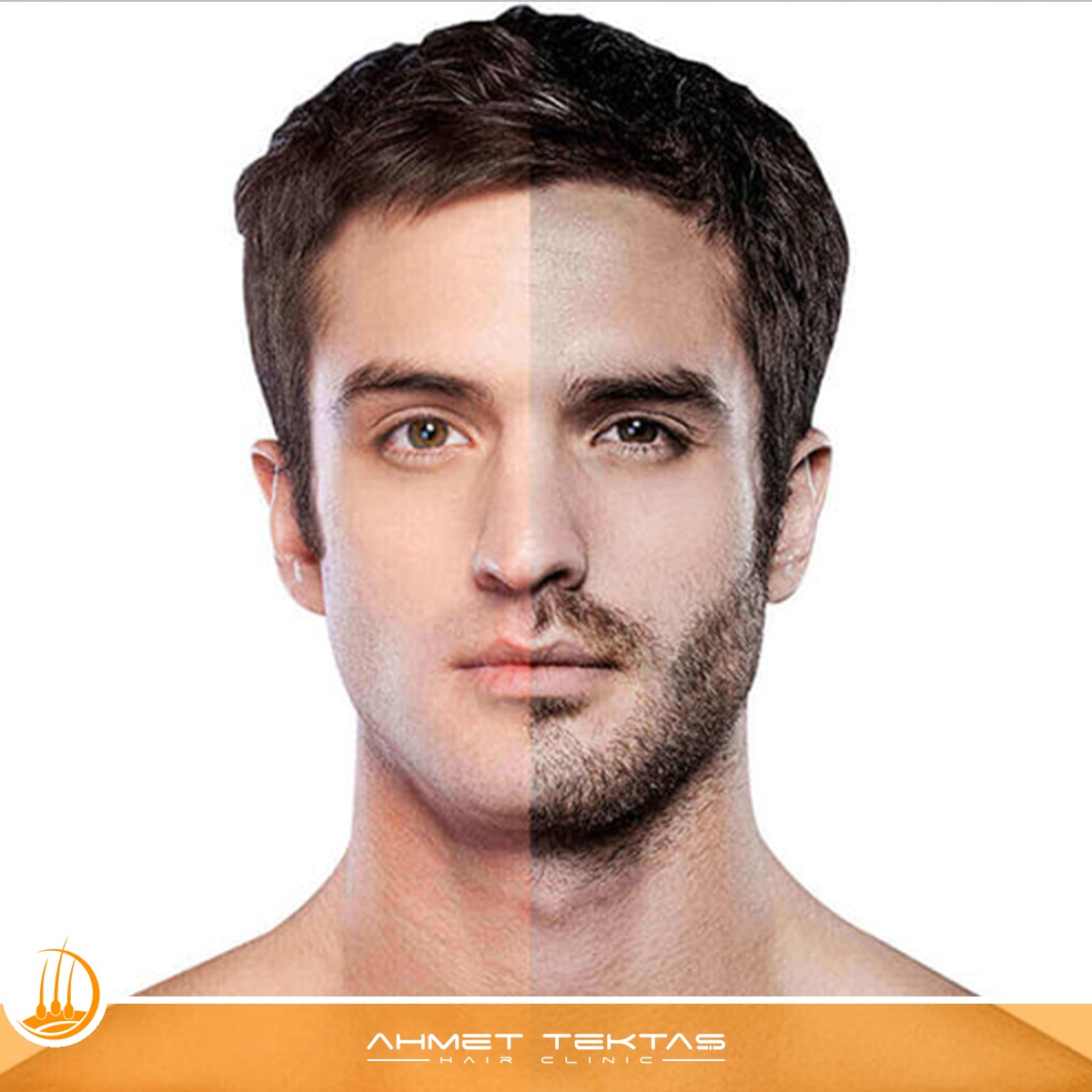 Nevşehir Sakal Ekimi