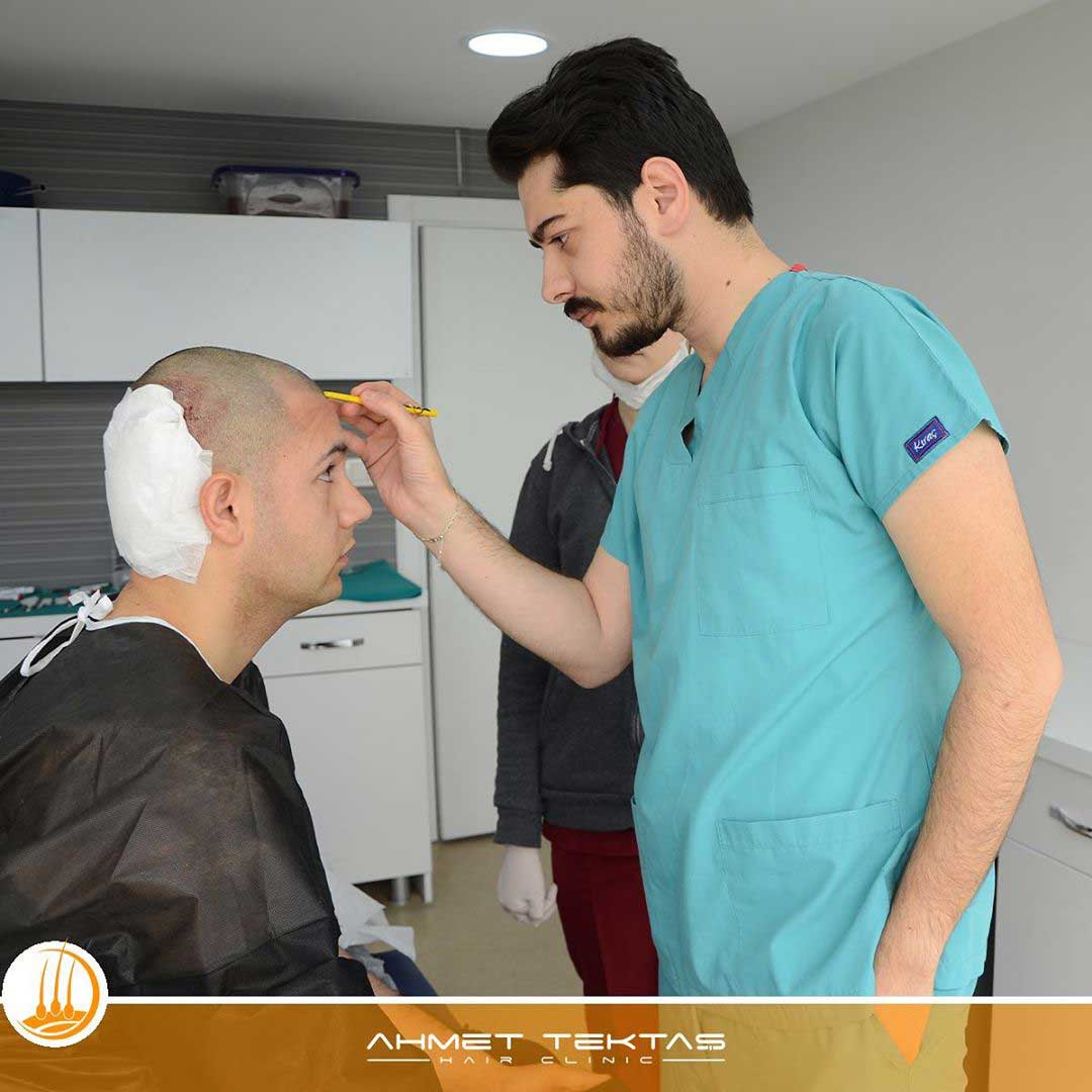 Sivas En İyi Saç Ekim Merkezi