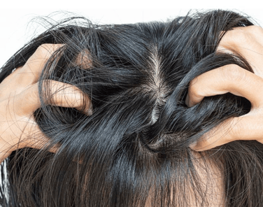 Saç Dipleri Neden Acır